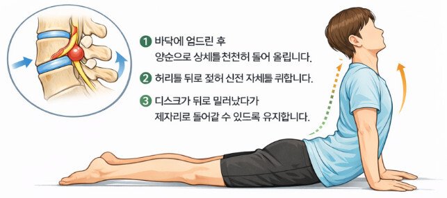 맥킨지 신전운동