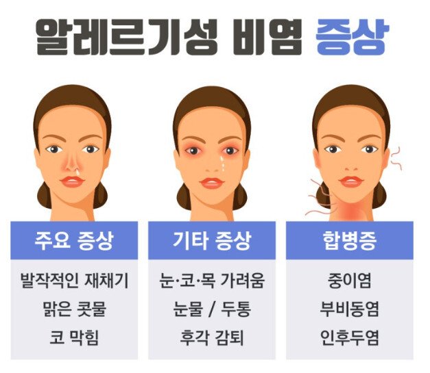 알레르기성 비염 증상